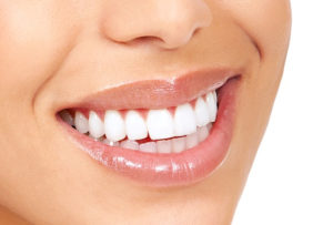 picture of a young woman's mouth smiling with white straight teeth