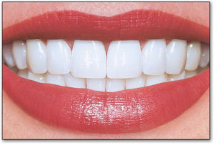 photo of a woman's mouth smiling with perfect white teeth