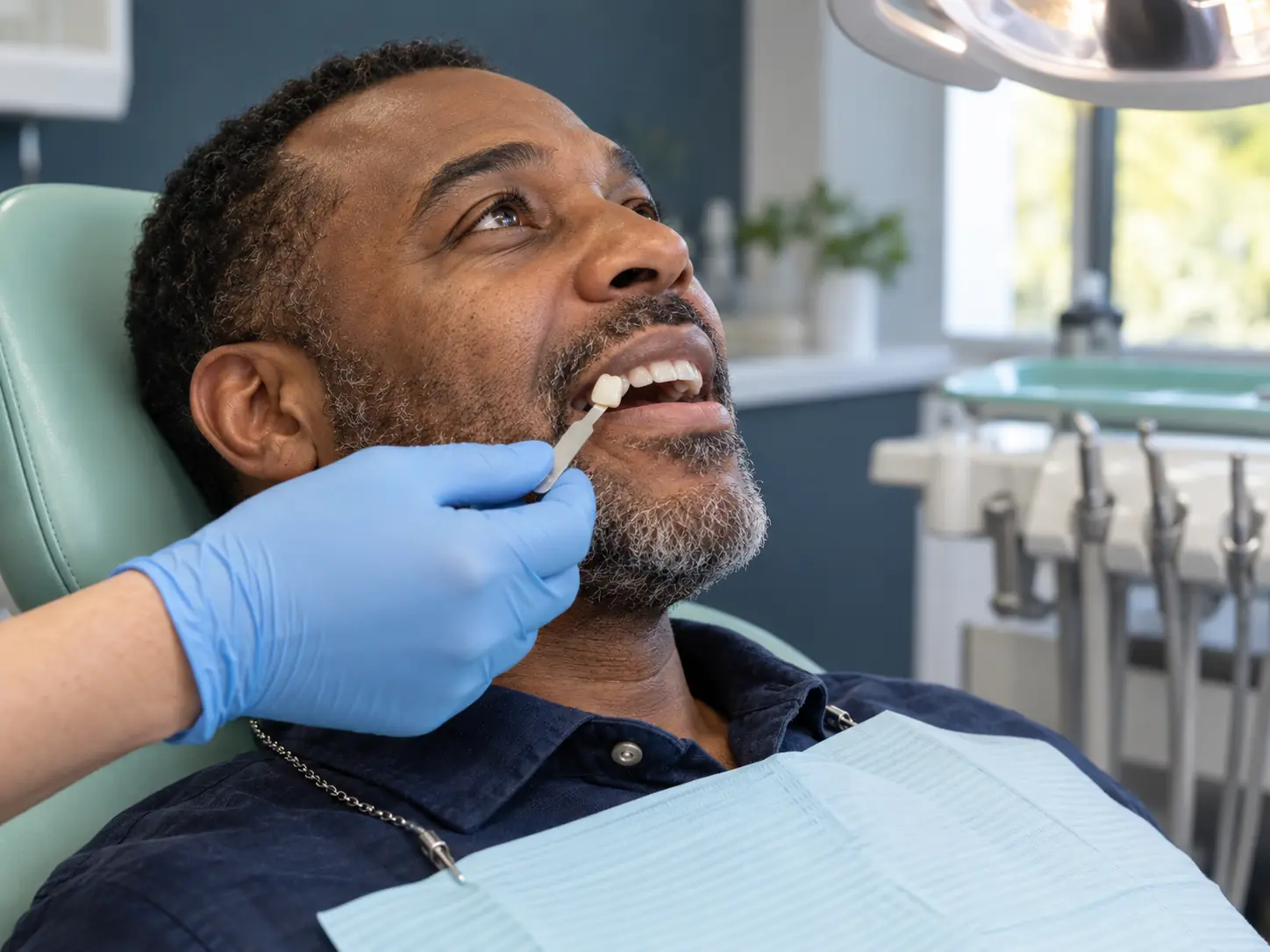Tooth shade matching for a dental crown
